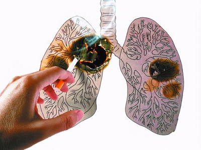 广州治疗肺癌医院排名|为什么从来不抽烟的女性患肺癌疾病率这么高