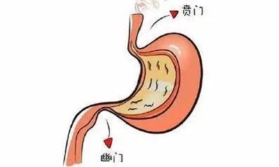 广州胃癌专科医院|这些症状是胃部疾病所有的表现,也是胃肿瘤的表现之一