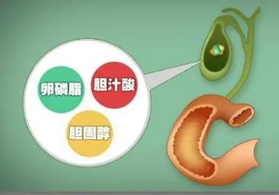 广州肿瘤中医馆医师:胆囊癌有哪些你所不知道的危险因素,学习一下