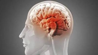 广州中医肿瘤医师:儿童神经胶质瘤有哪些特征呢