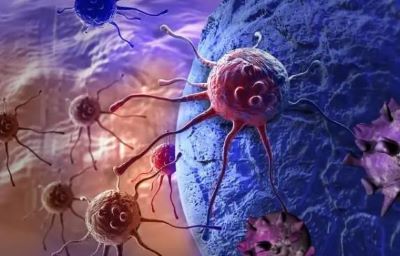 广州肿瘤医师:人体排毒的几个方法你知道几个？
