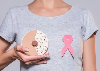 广州乳腺癌中医医师:乳腺癌都有哪些症状?又该怎么治疗呢