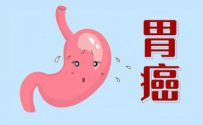 广州有没有治疗胃癌厉害的老中医
