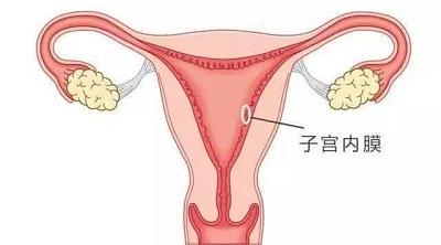 广州中医治疗子宫内膜癌医院哪家有效